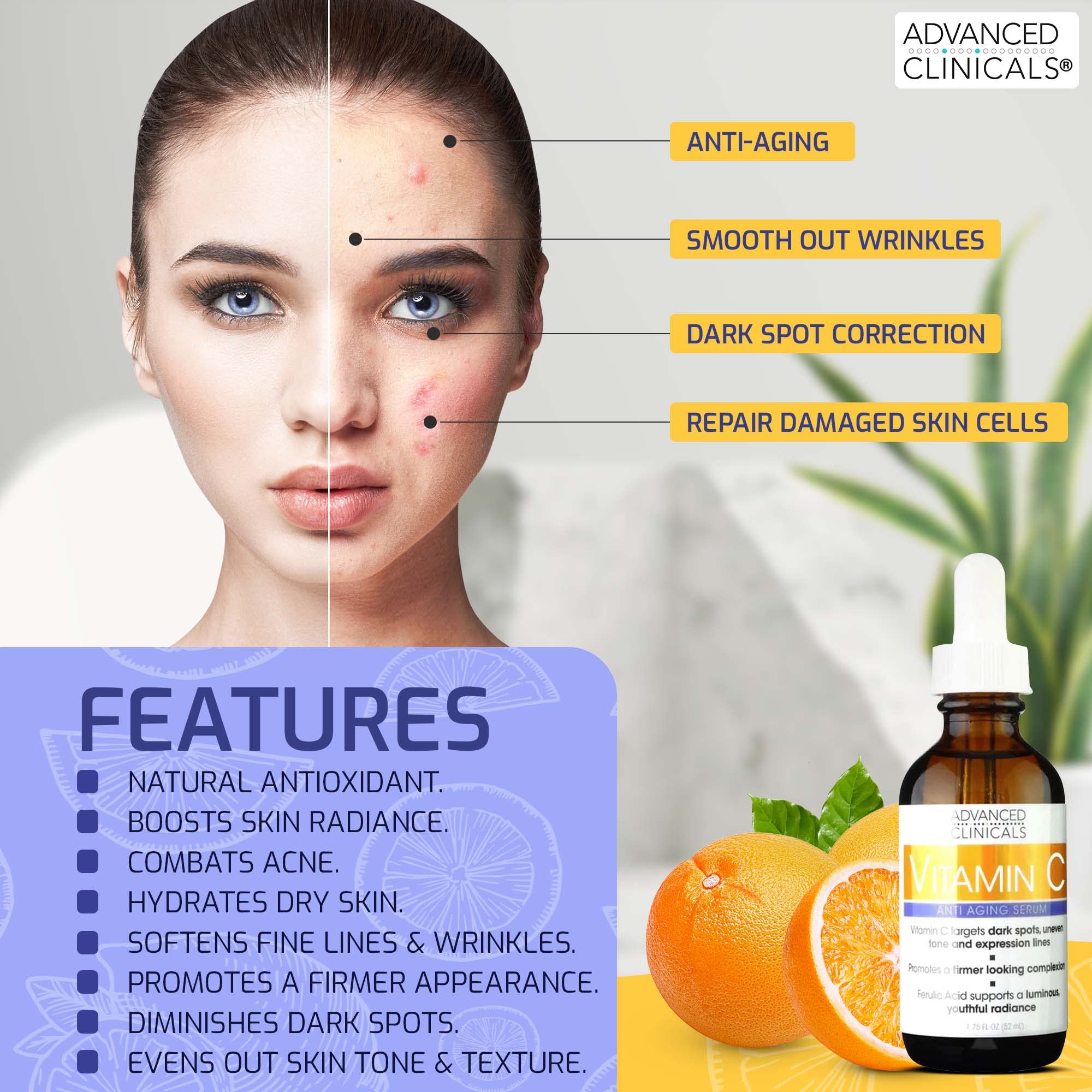 Advanced Clinicals Brightening Vitamin C Serum For Face With Glycolic Acid + Lactic Acid | Vitamin C Eye Serum Face Moisturizer For Improving Look Of Dark Spots & Uneven Complexion, 1.75 Fl Oz
