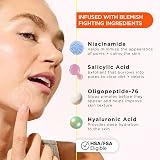 ZitSticka KILLA Kit Microdart Pimple Patches 4 Patches 4 Priming CLEANA view 3