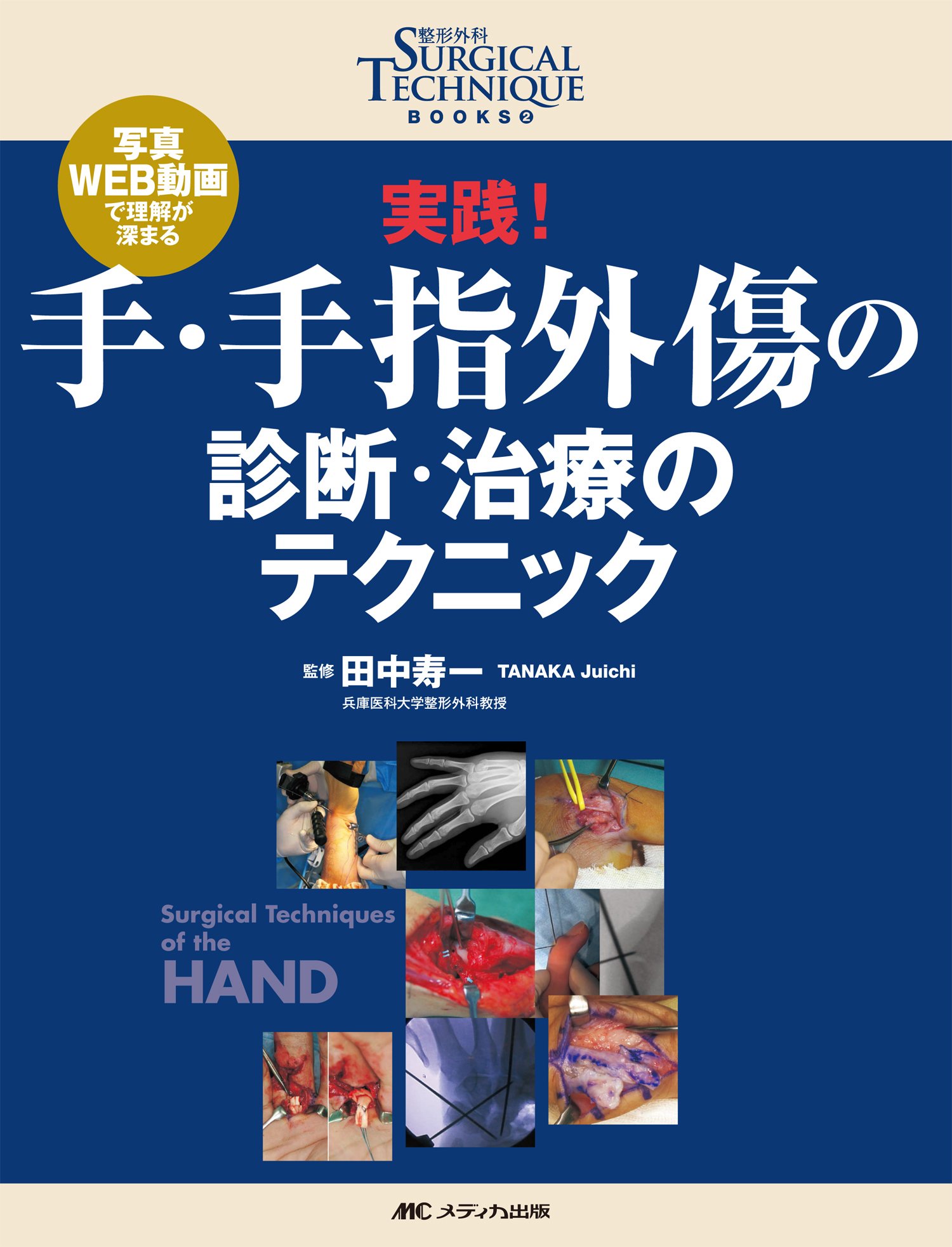 実践 手 手指外傷の診断 治療のテクニック 写真 Web動画で理解が深まる 整形外科surgical Technique Books 田中 寿一 本 通販 Amazon