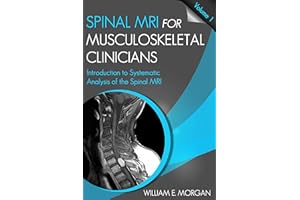 Introduction to Systematic Analysis of the Spinal MRI (Spinal MRI for Musculoskeletal Clinicians Book 1)