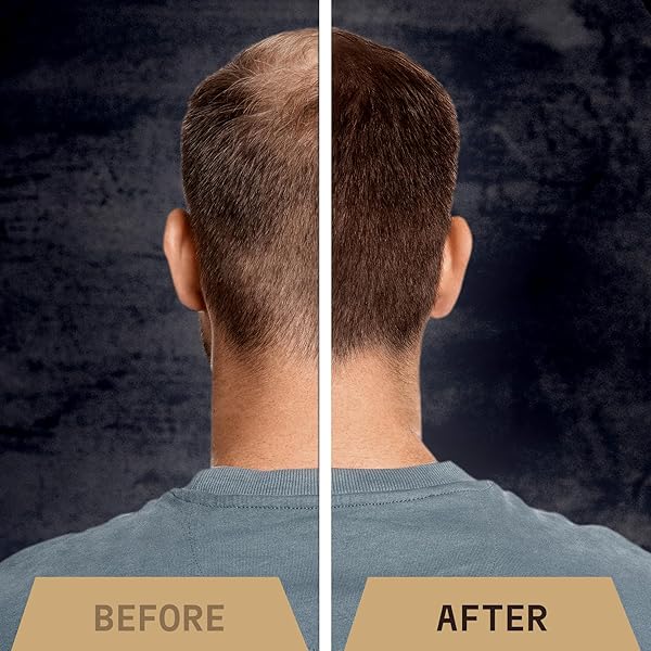 STRIKING VIKING HAIR FIBERS (MEDIUM BLONDE) 28G – NATURALLY DERIVED, LONG-LASTING BUILDING POWDER – UNDETECTABLE FOR THINNING HAIR, FOR MEN & WOMEN