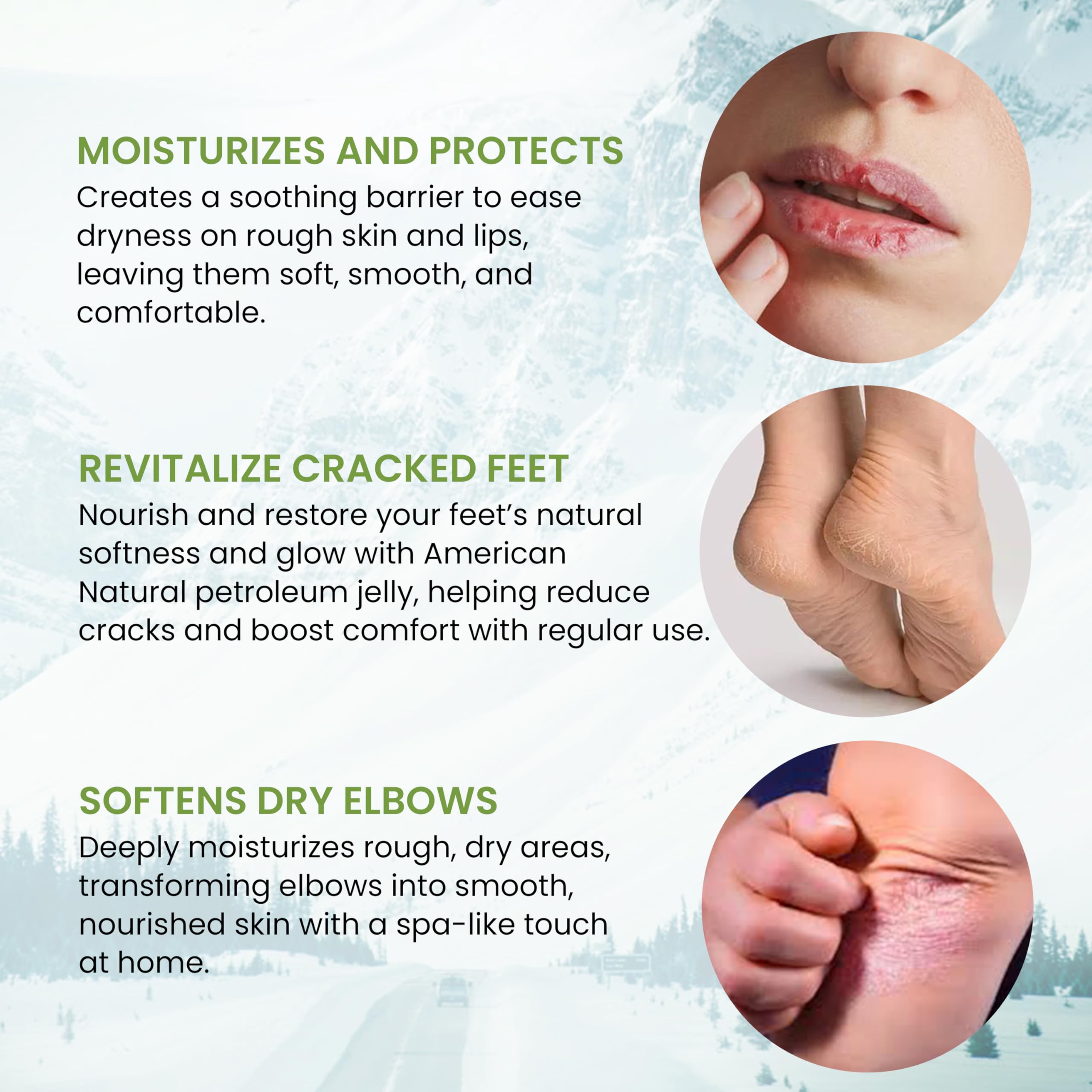 American Natural 100% Pure Ultra White Petroleum Jelly (12 Oz) - Travel Size Petrolatum Skin Protectant for Minor Cuts, Burns, Eczema & Diaper Rash, Multi-Use Organic Moisturizer for All skin type