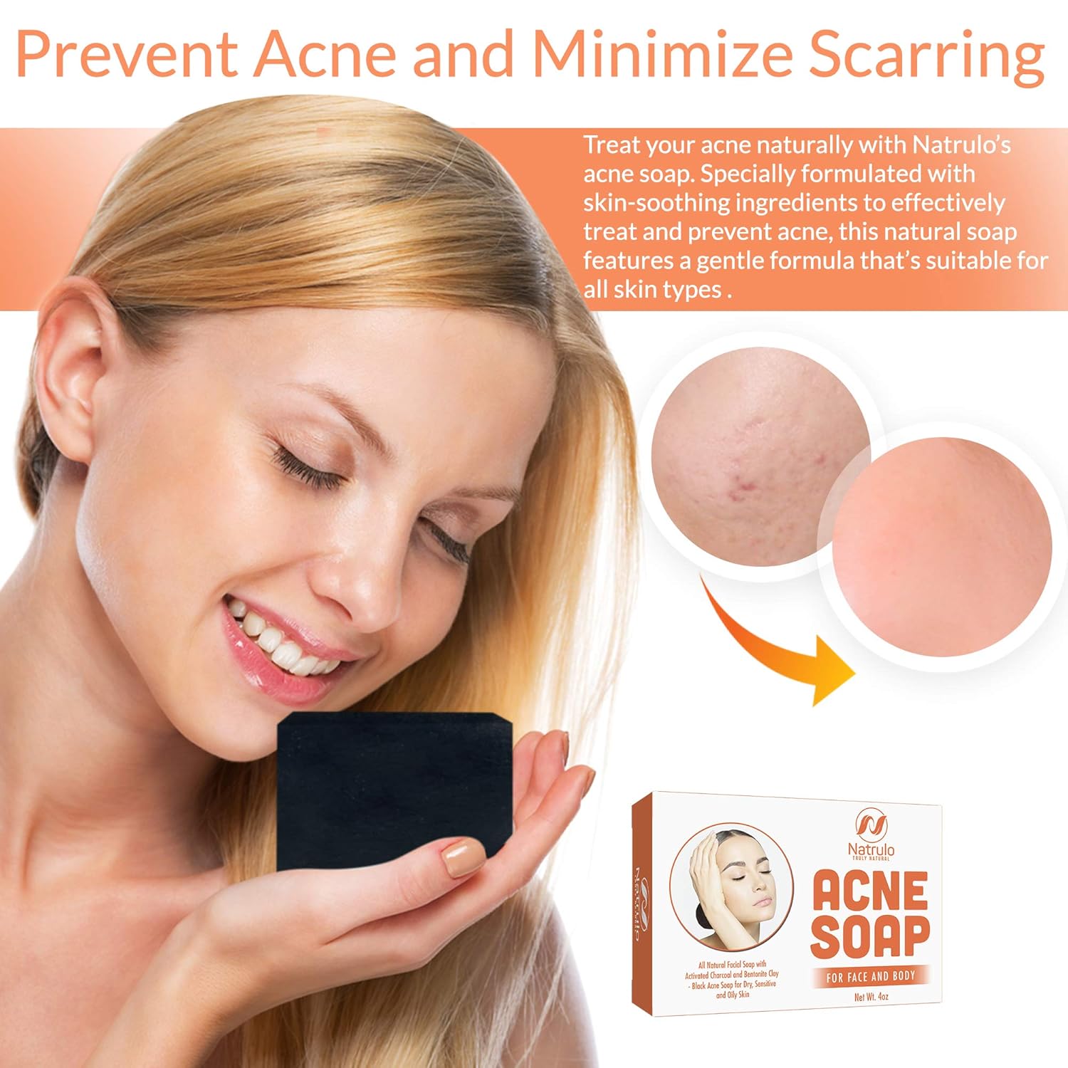 Natrulo Acne Bar Soap with Activated Charcoal & Bentonite Clay - Black Acne Soap for Dry, Sensitive & Oily Skin - All Natural Facial Soap for Pimples & Scars - Homeopathic Acne Treatment Made in USA: Beauty