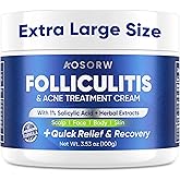 AOSORW Folliculitis & Acne Treatment Cream – Salicylic Acid & Herbal Extracts for Scalp, Face, Body & Back – Soothes Irritated Skin, Redness & Itch Relief – 100g (Pack of 1)