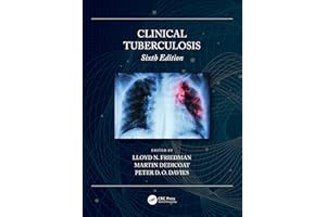 Clinical Tuberculosis