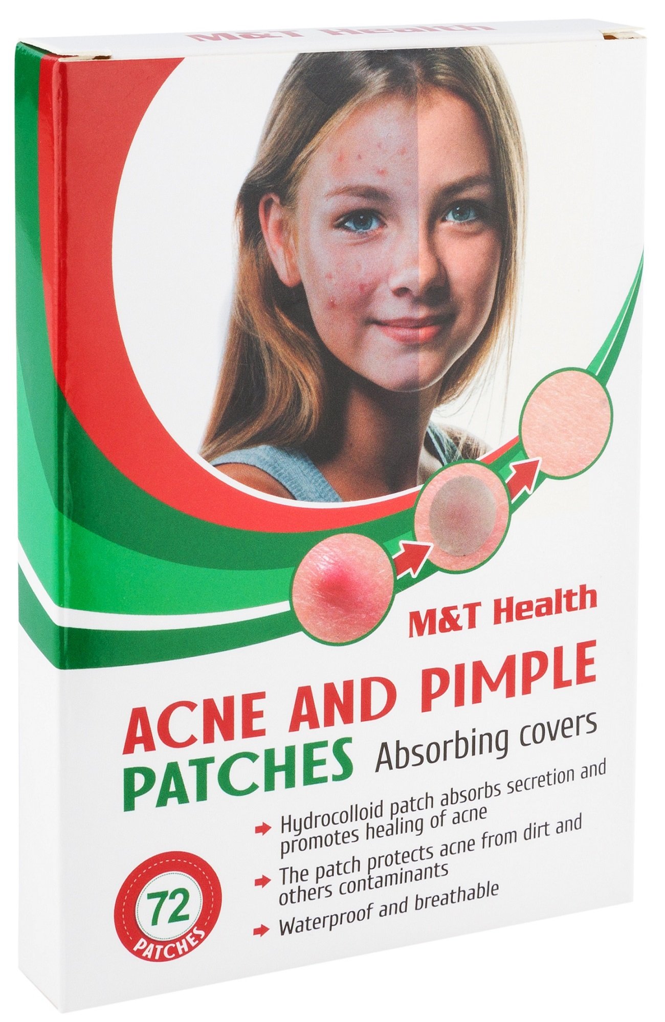 Acne Pimple Patch Master Hydrocolloid Dressing Skin Care 72 Count