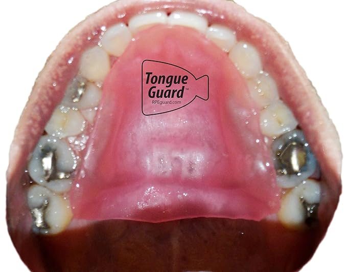 Amazon Com Proteccion De Lengua Rpe Evita Y Ayuda A Curar Las