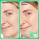 Revolution Skincare Clearly Clarify 4 Step Starter Kit 4-Piece Set view 3