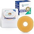 NuBliss Moldable Ostomy Barrier Ring – 10-Pack Leak-Free Hydrocolloid Skin Adhesive Ostomy Supplies – 4mm Thick, Flexible Stoma Protector Seal for Colostomy & Ileostomy Bags – FSA & HSA Eligible