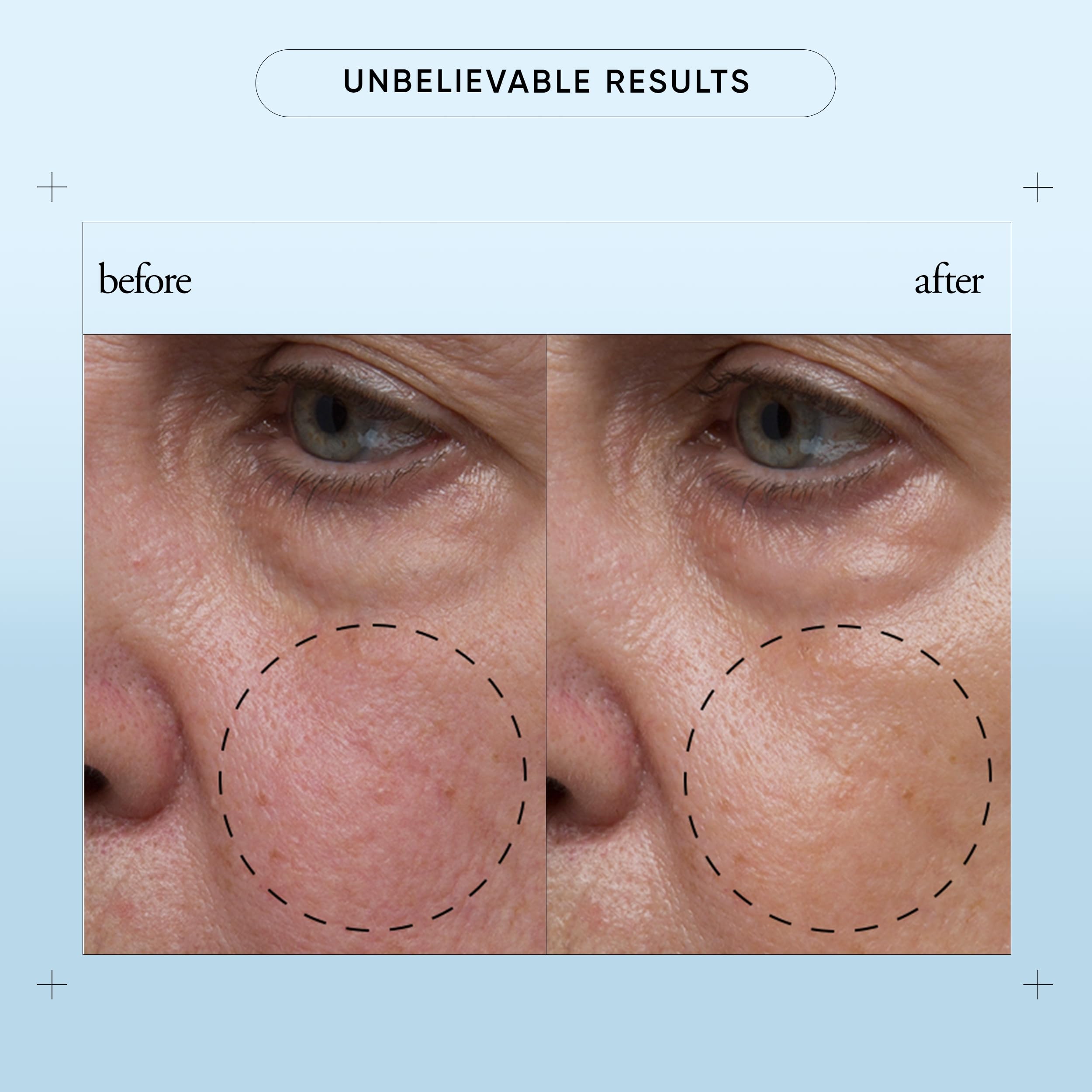 philosophy hope in a jar biome-balance glow facial serum - with enhanced hyaluronic acid, prebiotic & AA2G - helps restore natural balance & provides instant, supercharged hydration - 1 fl oz