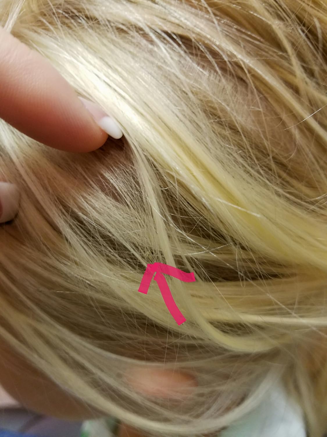 Buy Wipe Out Natural Lice Treatment Online At Low Prices In India