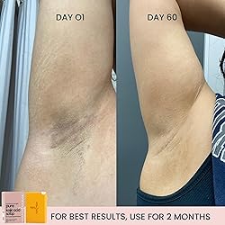 Pure Kojic Acid Soap Bar for Hyperpigmentation and