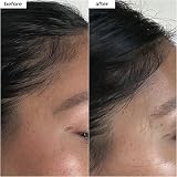 Briogeo Destined For Density MegaStrength Serum Caffeine Biotin Peptide 45ml view 4