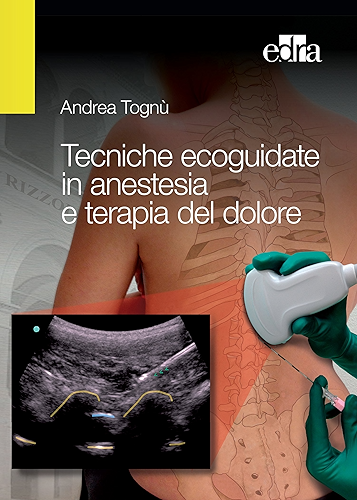 Download Tecniche ecoguidate in anestesia e terapia del dolore (Italian Edition) PDF