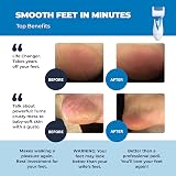 Own Harmony Electric Hard Skin Remover with 3 Coarse Diamond Rollers view 2