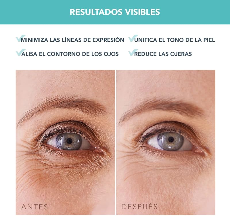IRIS Parches Ojos com Colageno - Contorno de Ojos Antiojeras - Vitamina B, Vitamina C y Vitamina E - Retinol - Antiojeras Mujer - Hidratante - Vegano - 60 Parches Ojos Bolsas y Ojeras