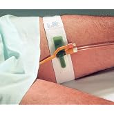 Special Pack of 5 Foley Catheter Holder Dale - Dale Medical 316 | 2 in Wide Band, Soft Supple Backing, Stretch Fabric, Indwelling Tube Support, 365 Day Shelf Life, Expiration Dated