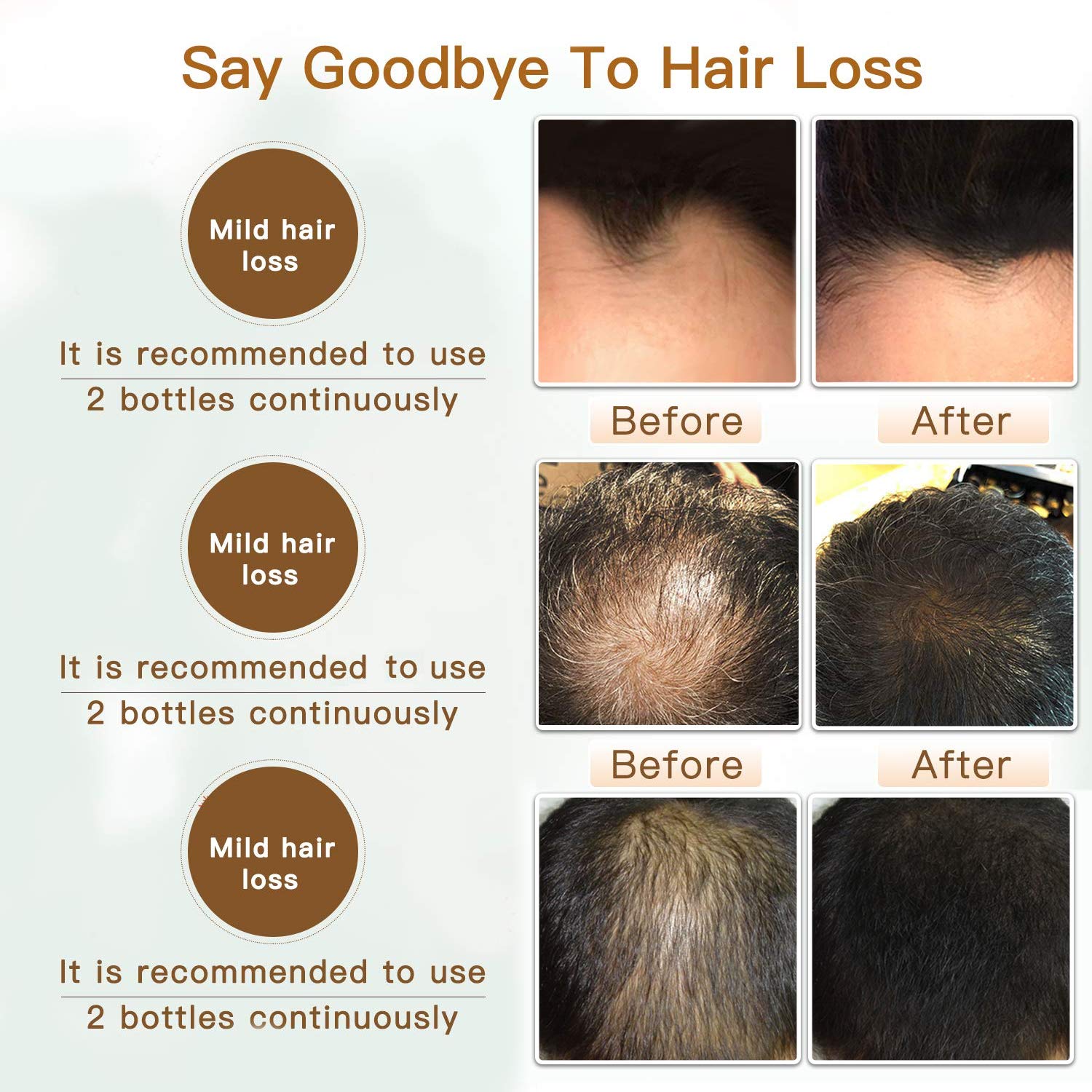 Hair Growth Serum MayBeau Essential Oil Upgrated Hair Growth Treatment With Thinning Hair Loss Hair Loss Treatment for Men and Women : Beauty