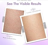 DERMAdoctor KP Bump Eraser Body Scrub 10% AHAs PHAs Keratosis Pilaris Dry Bumpy view 3