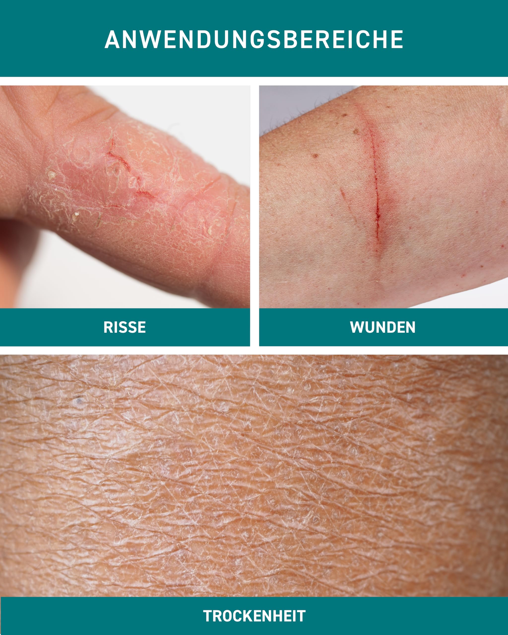 N1 Mikrosilber Handcreme für sehr trockene Hände 250ml [inkl. Desinfektion] - Handcreme rissige Hände + Desinfektionsmittel für Hände in einem Produkt 3