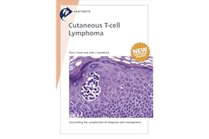 Fast Facts: Cutaneous T-cell Lymphoma