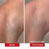 First Aid Beauty Ingrown Hair Pads with BHA & AHA – 60 Pads Daily Treatment view 3