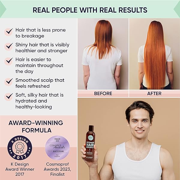 MOERIE ULTIMATE HAIR GROWTH CONDITIONER – FOR LONGER, THICKER, FULLER HAIR – VEGAN FRIENDLY VOLUMIZING HAIR PRODUCTS – PARABEN & SILICONE FREE – ALL HAIR TYPES – REVERSE HAIR LOSS – 8.45 FL OZ (250ML)