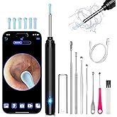 Ear Wax Removal Kit,Ear Cleaner with Camera,Ear Cleaning Kit 1269P HD Otoscope with Lights and 6 Ear Picks, Earwax Removal fo