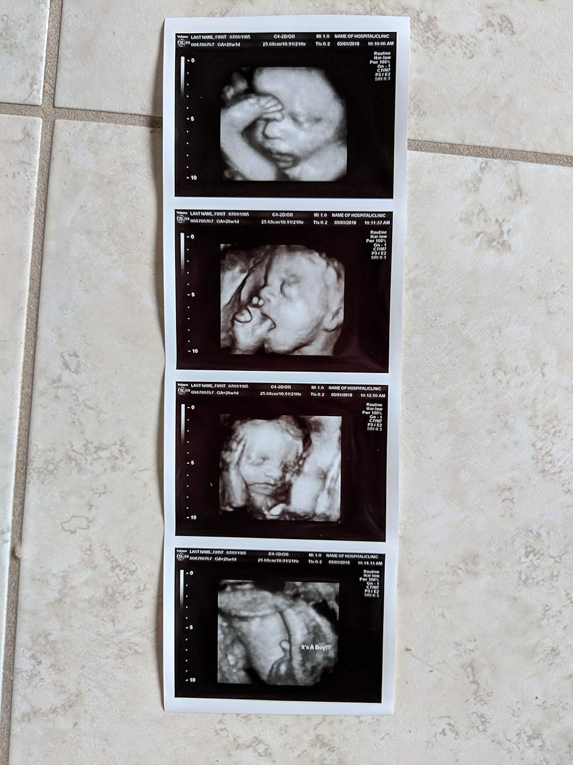 Photographs - Prank 3D Customized Fake Ultrasound Strip of 4 Photos