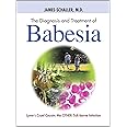 The Diagnosis and Treatment of Babesia