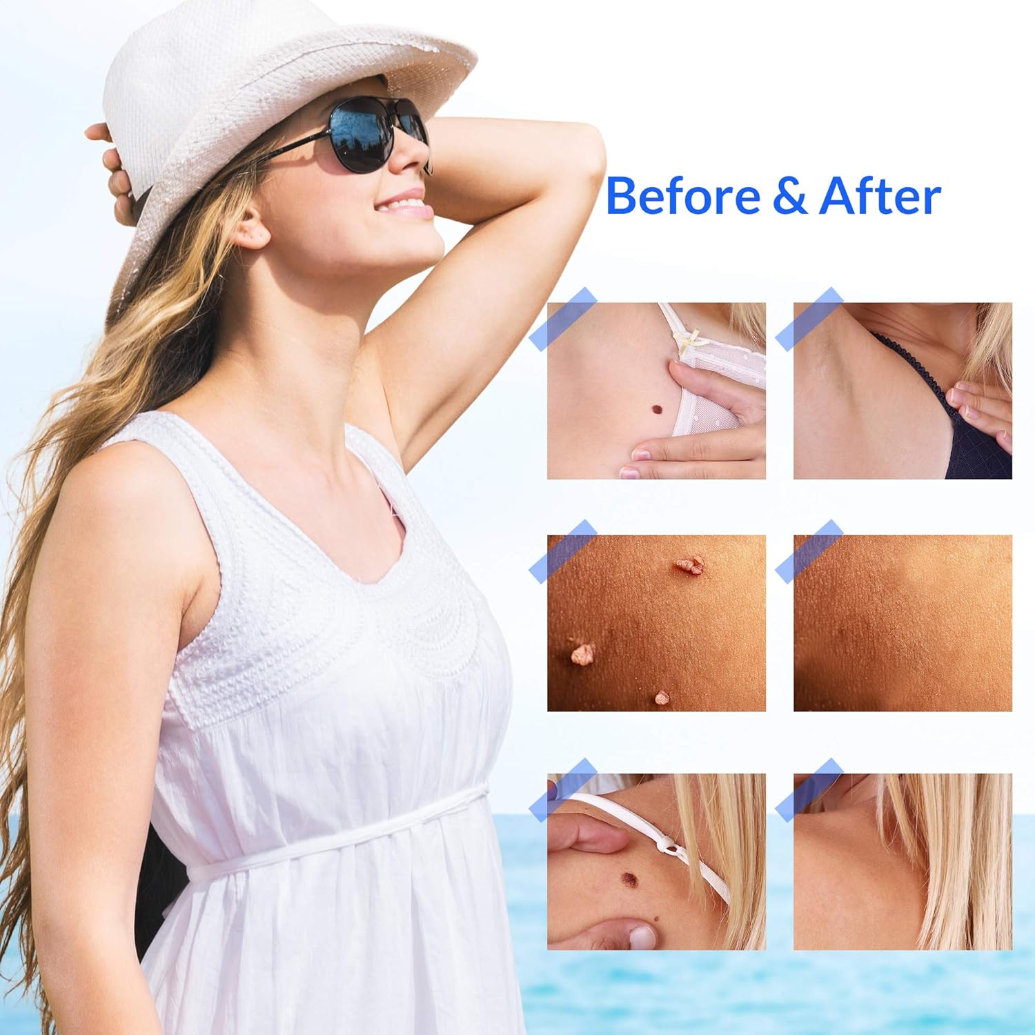 Novome Skin Tag Remover Patches - Wart Remover Patches - Natural Ingredients - Cover And Conceals Skin Tags - Perfect For All Skin Types (108 Patches)… : Beauty