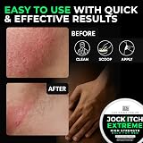Sera Organics Jock Itch Cream for Men – Natural Antifungal Balm 30ml UK view 4