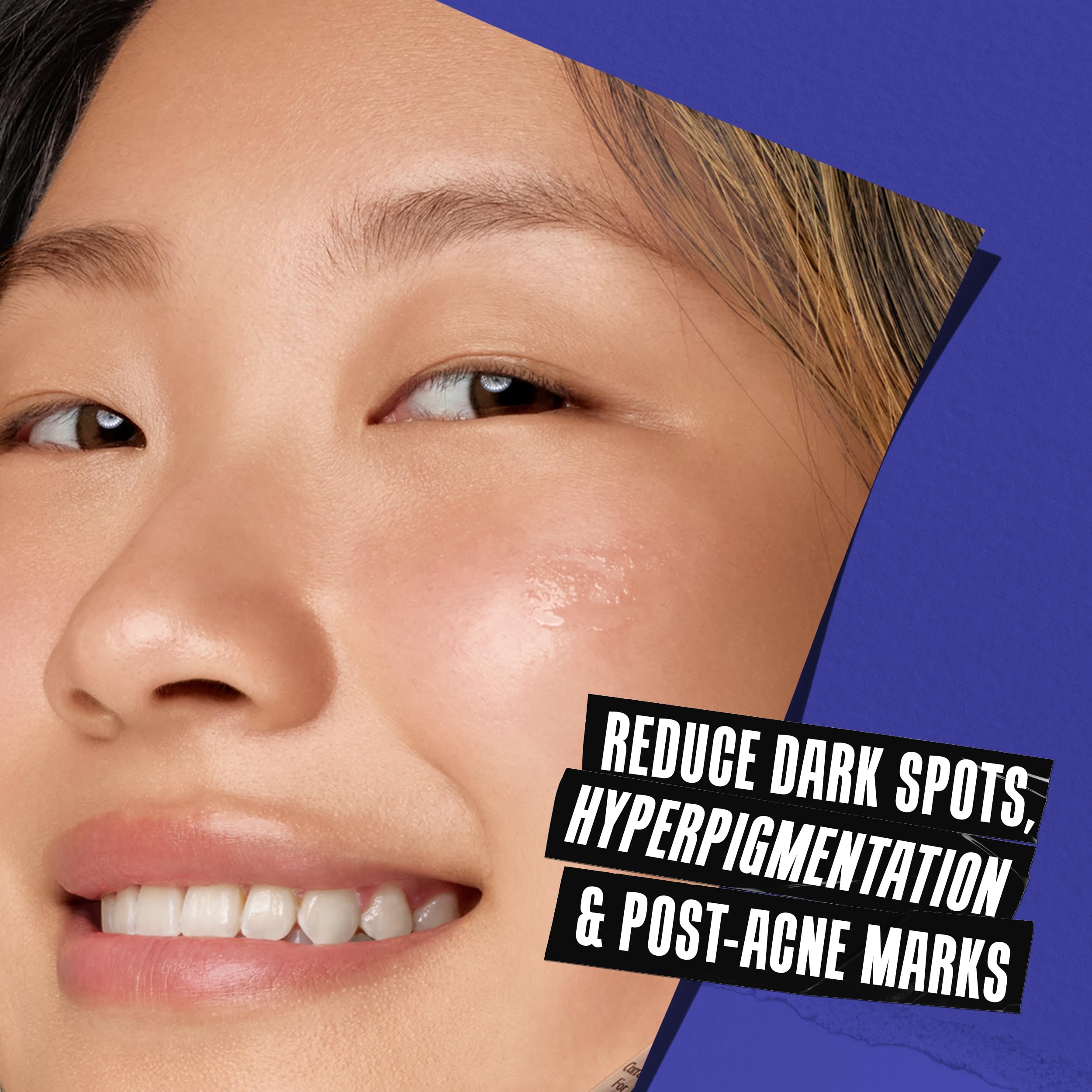 Kiehl's Clearly Corrective Dark Spot Serum, Brightening Facial Serum, Reduces Hyperpigmentation & Post-acne Marks, with Vitamin C & Salicylic Acid, All Skin Types, Paraben-free, Mineral Oil-free