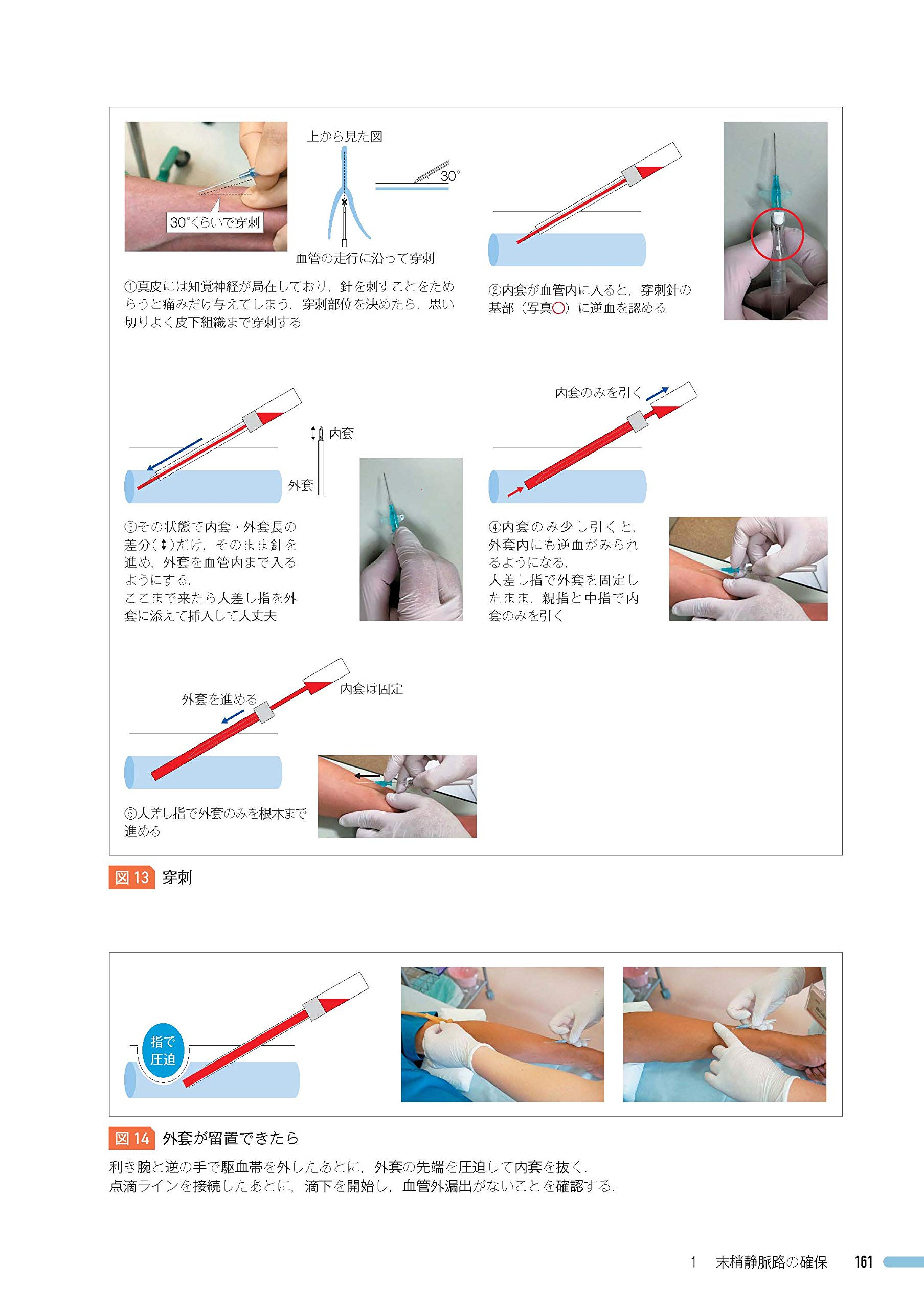 専門医が教える 研修医のための診療基本手技 大村 和弘 本 通販 Amazon