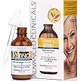 Advanced Clinicals Retinol Serum For Face | Resurfacing Retinol Serum Concentrate Skin Care Moisturizer | Anti Aging Renewing Facial Serum For Wrinkles, Fine Lines, & Uneven Skin Tone, 1.75 Fl Oz