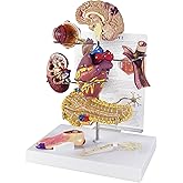 GPI Anatomicals Type II Diabetes Model Set | Human Body and Anatomy Replica for Physiology Education, Anatomical Model for Doctor's Office, Medical Learning Resources