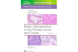 Biopsy Interpretation of the Uterine Cervix and Corpus: Print + eBook with Multimedia