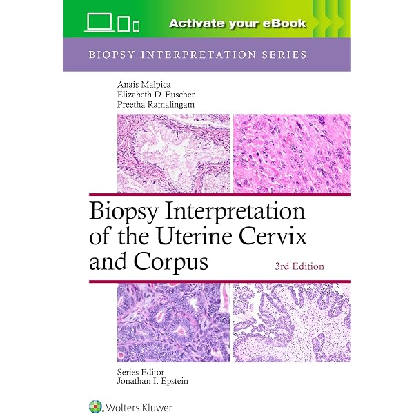 Rosen's Breast Pathology: 9781496398918: Medicine & Health Science