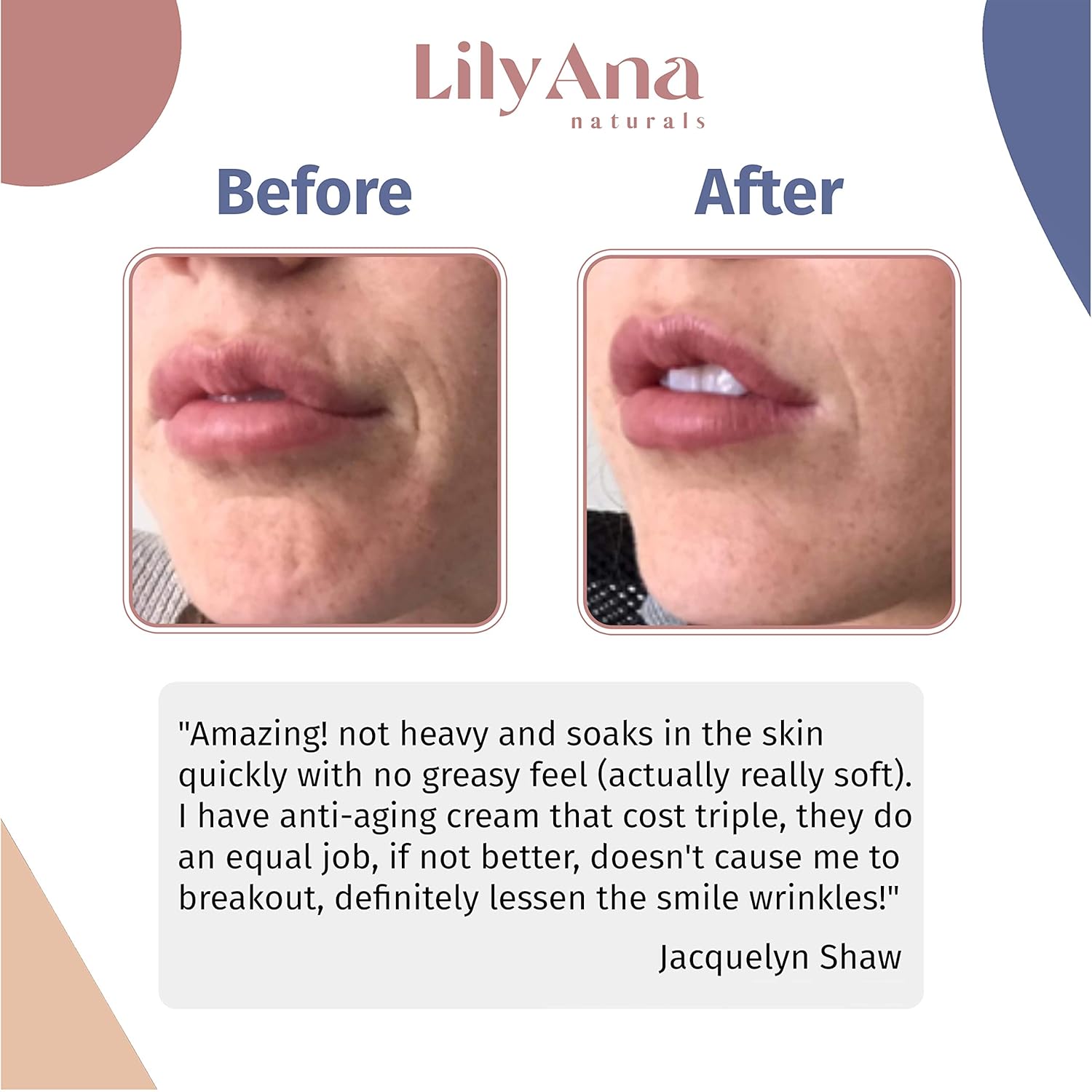 LilyAna Naturals Retinol Cream for Face - Retinol Cream, Anti Aging Cream, Retinol Moisturizer for Face, Wrinkle Cream for Face, 2.5% Retinol Complex - 1.7oz: Beauty