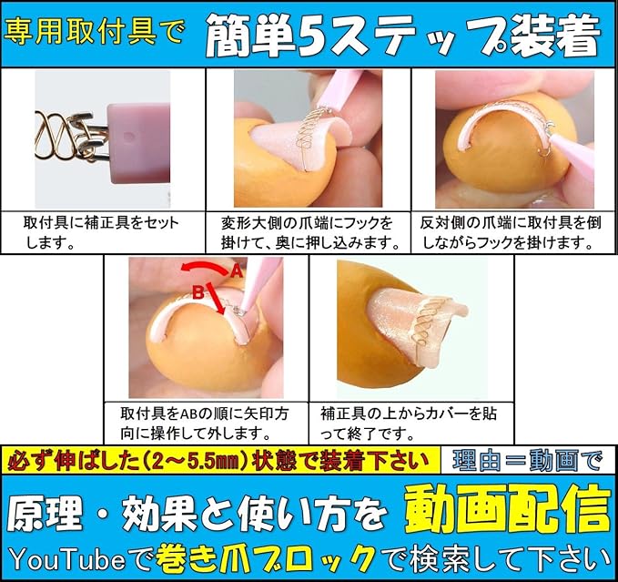 巻き爪ブロック セット品 ノーマルタイプ M