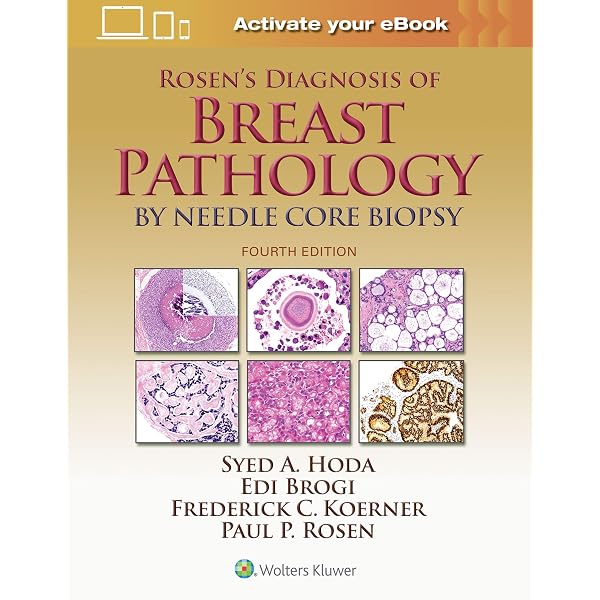 Rosen's Diagnosis of Breast Pathology by Needle Core Biopsy