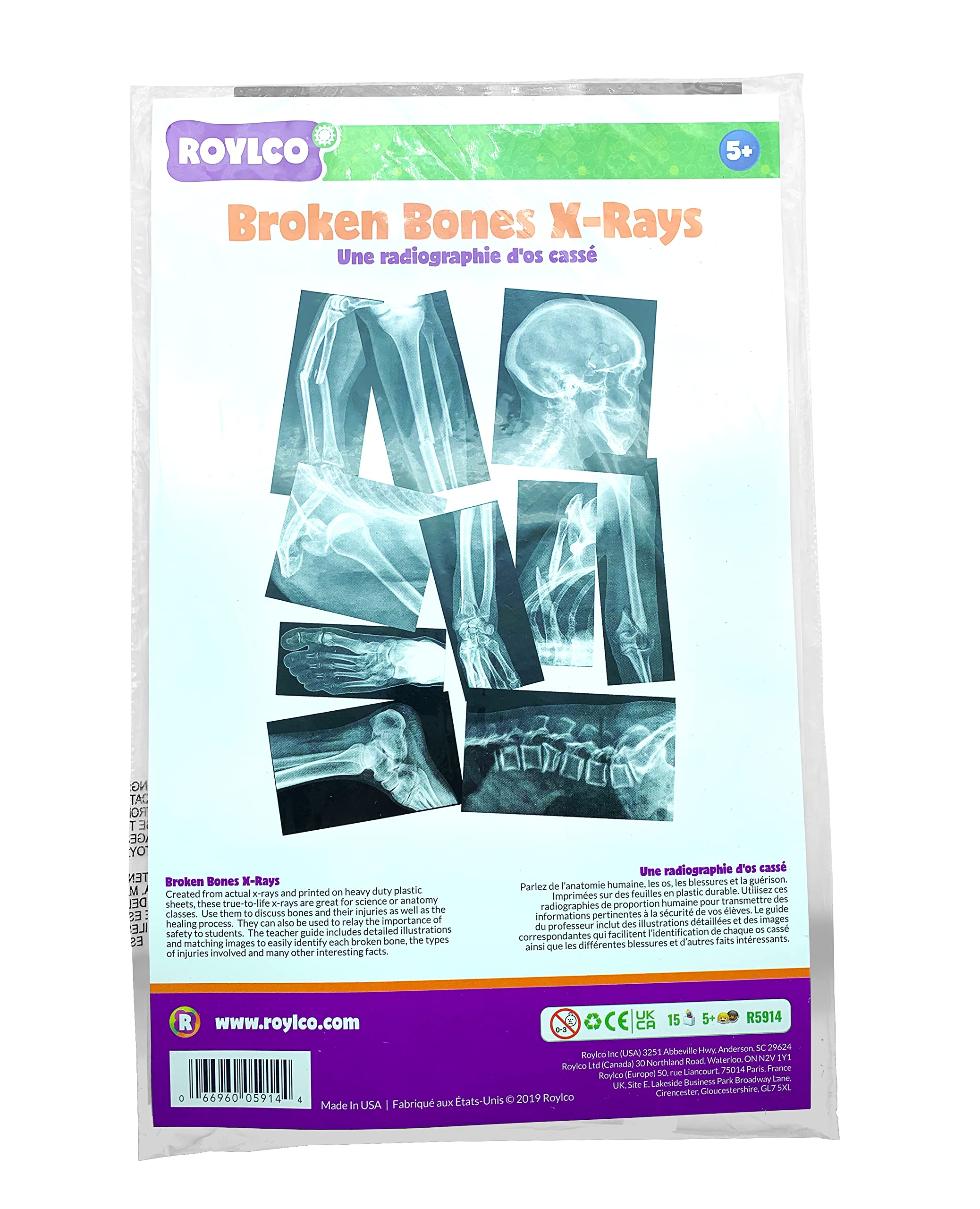 Roylco Broken Bones X-Ray Set, Projector Display Compatible, 15 X-Rays