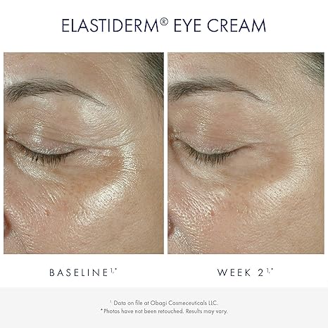 elastiderm eye cream walmart
