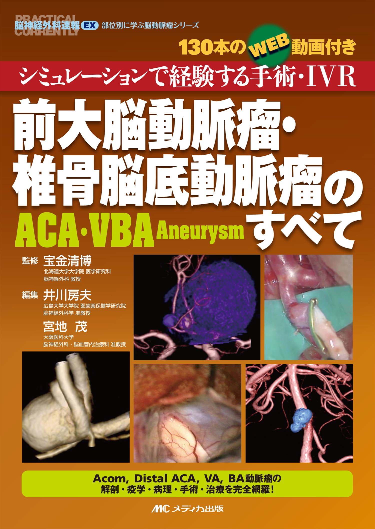 前大脳動脈瘤 椎骨脳底動脈瘤 Aca Vba Aneurysm のすべて シミュレーションで経験する手術 Ivr 130本のweb動画付き 脳神経外科速報ex 部位別に学ぶ脳動脈瘤シリーズ 宝金 清博 井川 房夫 宮地 茂 本 通販 Amazon