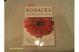 Rosacea: Your Self-Help Guide