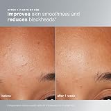 Dermalogica Daily Microfoliant 74g Gentle Exfoliating Powder with Rice Enzymes view 4