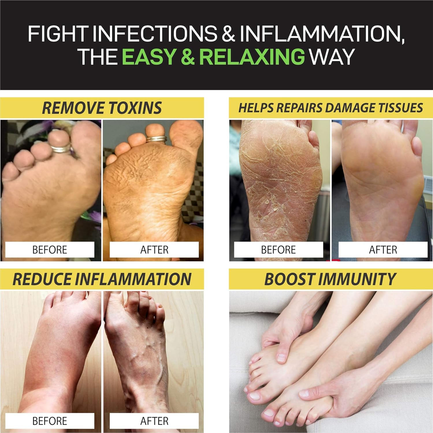 Citrus Detox Foot Soak with Epsom Salt - Removes Toxins, Foot Callus, Boost Immune, Helps Treat Athletes Foot, Inflammation, Tired, Aching Feet and Toenail Fungus lbs1: Beauty