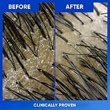 Head & Shoulders Clarify & Shine Anti-Dandruff Shampoo 800ml view 5