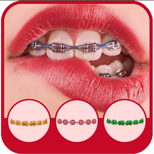 Braces photo editor
