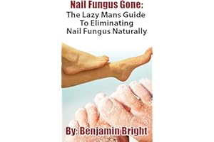 Nail Fungus Treatment:The Lazy Man Guide To Curing Nail Fungus Infections Naturally